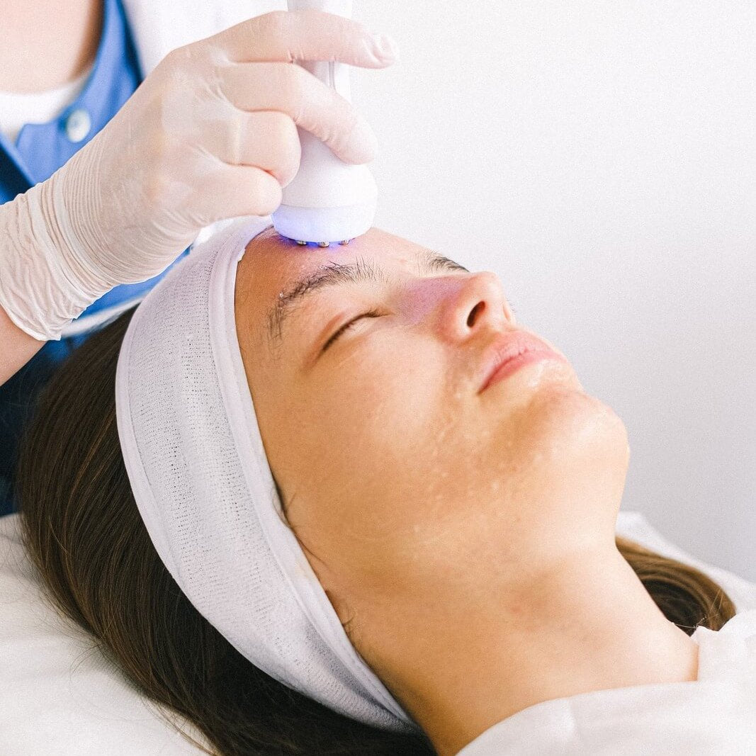 Focus Ultrasound Skin Tightening